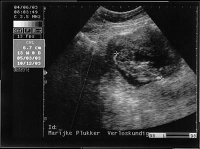 Meike echo 2
